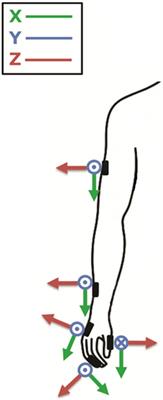 Quantitative Analysis of Bradykinesia and Rigidity in Parkinson’s Disease